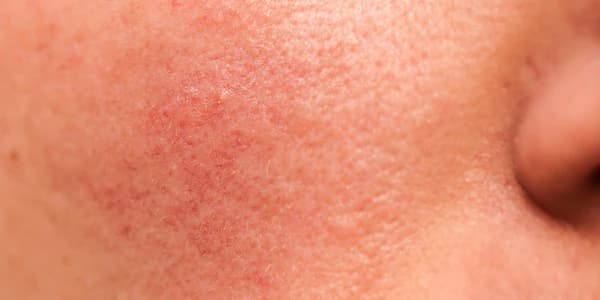 Hydration & Barrier Care